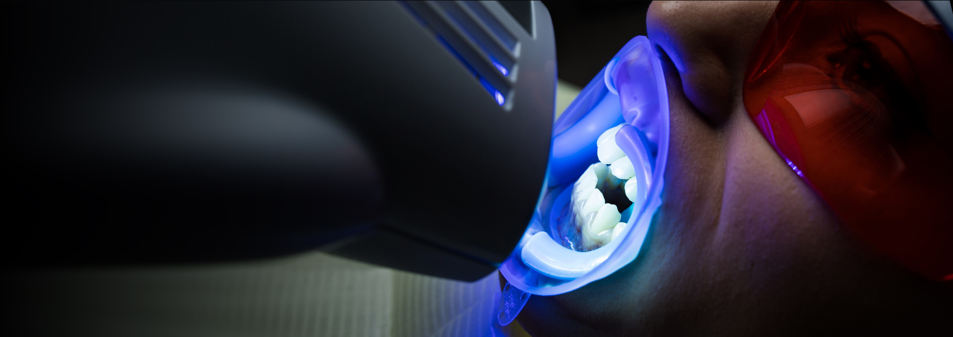 Teeth Whitening 