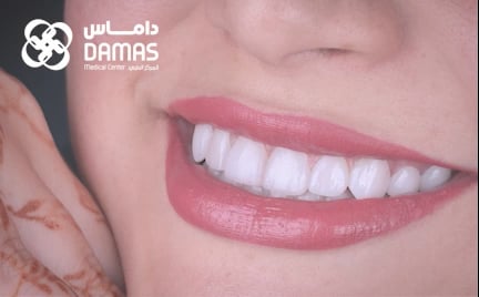 testimoial-6d- Elite smile